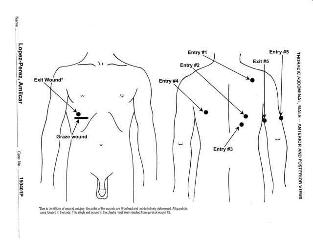 This diagram from the autopsy report shows that Lopez Perez was shot in the back
