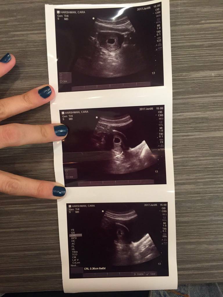 I just had an abortion and I am so lucky