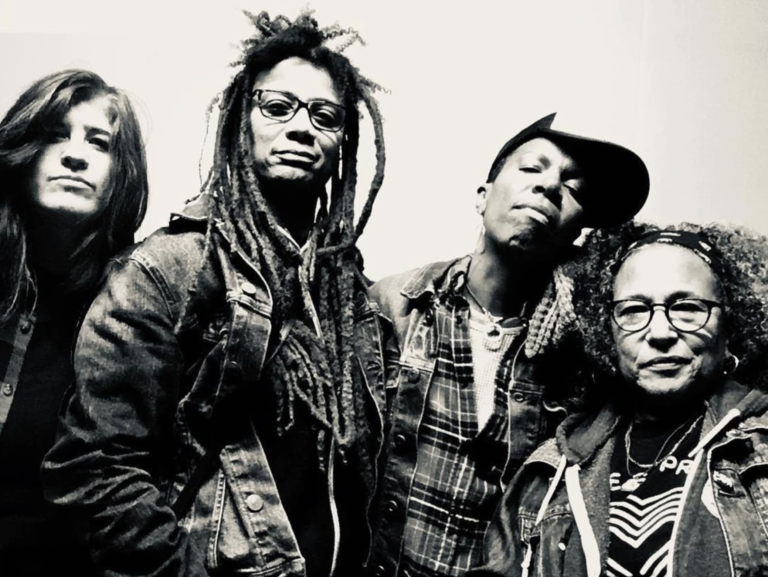 Best of the Bay 2024 Editors’ Pick: Skip the Needle